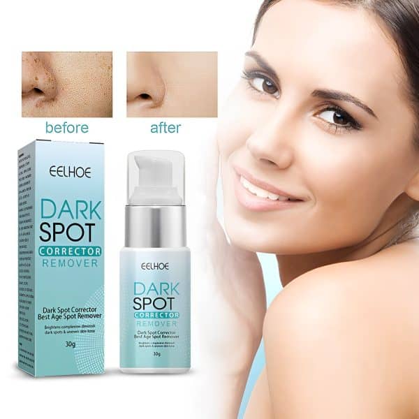 This Dark Spot and Freckles Remover Cream is made with pure natural ingredients for dark spots and freckles clearing. It is very effective.